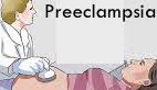 Preeclampsia