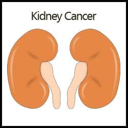 Nutrition And Kidney Cancer
